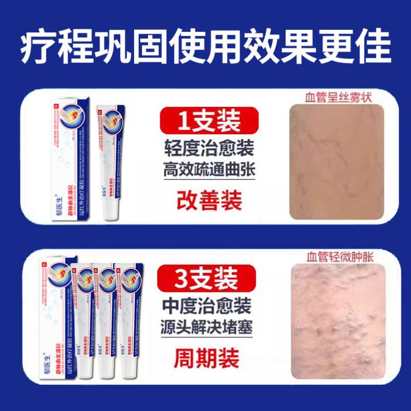 「郁医生远红外治疗凝胶静脉官方旗舰店正品外用腿部蚯蚓腿」