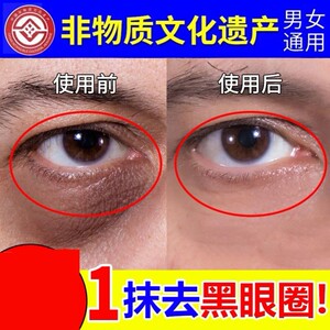 黑眼圈去除男士神器专用抗皱提拉紧致眼霜淡化眼袋官方正品旗舰店