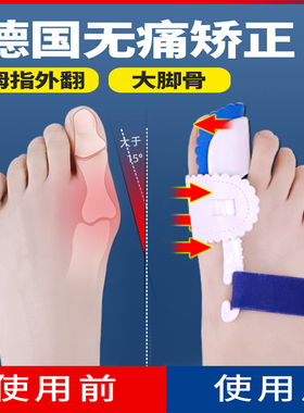 德国拇指外翻矫正器分大母脚趾头足改善纠正大脚骨可以穿鞋男女士