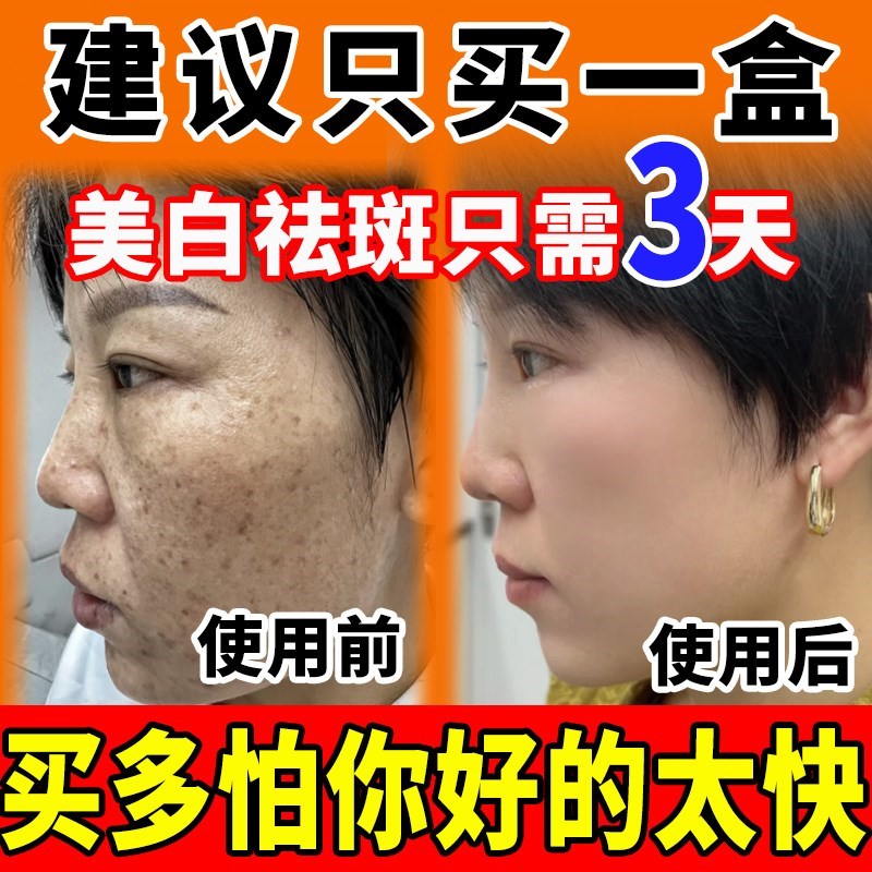 男士美白护肤品男脸部面霜美白提亮去黄改善暗沉肤色洗面奶淡祛斑