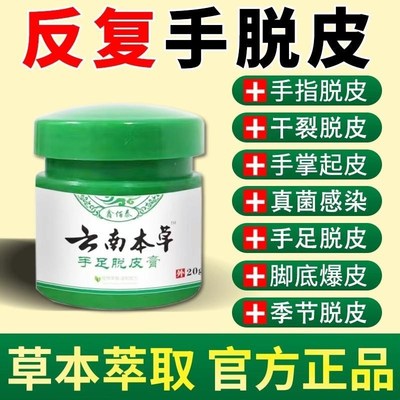 云南手足脱皮膏手指上起皮干燥抑菌儿童手掌蜕皮手心手脚掉皮