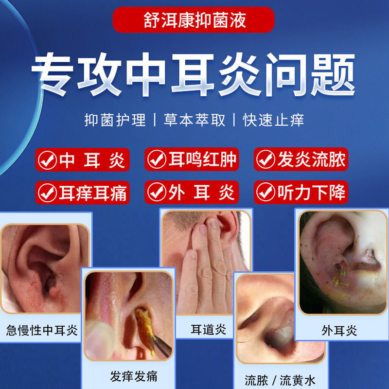 中耳炎滴耳液治疗耳痛流脓水耳鸣