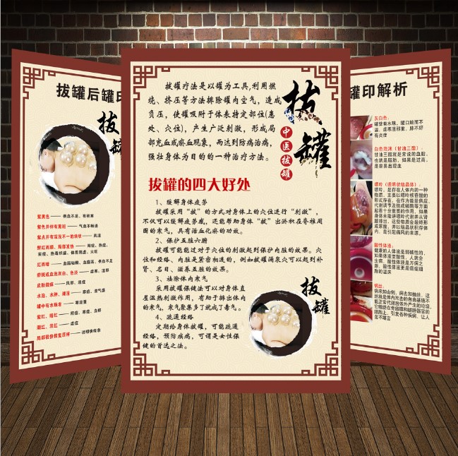 中医拔罐禁忌墙贴拔火罐的好处挂图拔罐刮痧海报养生宣传画大挂图
