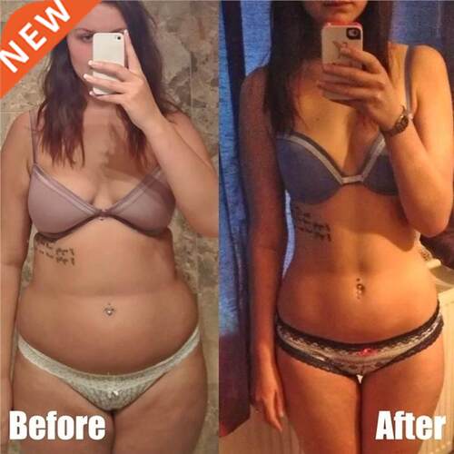10pcs Weight Slimming Patch Sleep Burning Fat Loss Magnets
