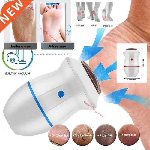 Scraper Grinder Heel-Removal Vacuum-Foot Electric File-Machi