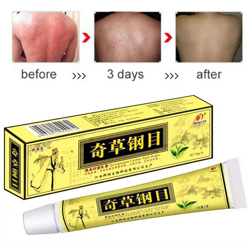 Dropshipping 20PCS QICAOGANGMU Focallure Skin Psoriasis Crea