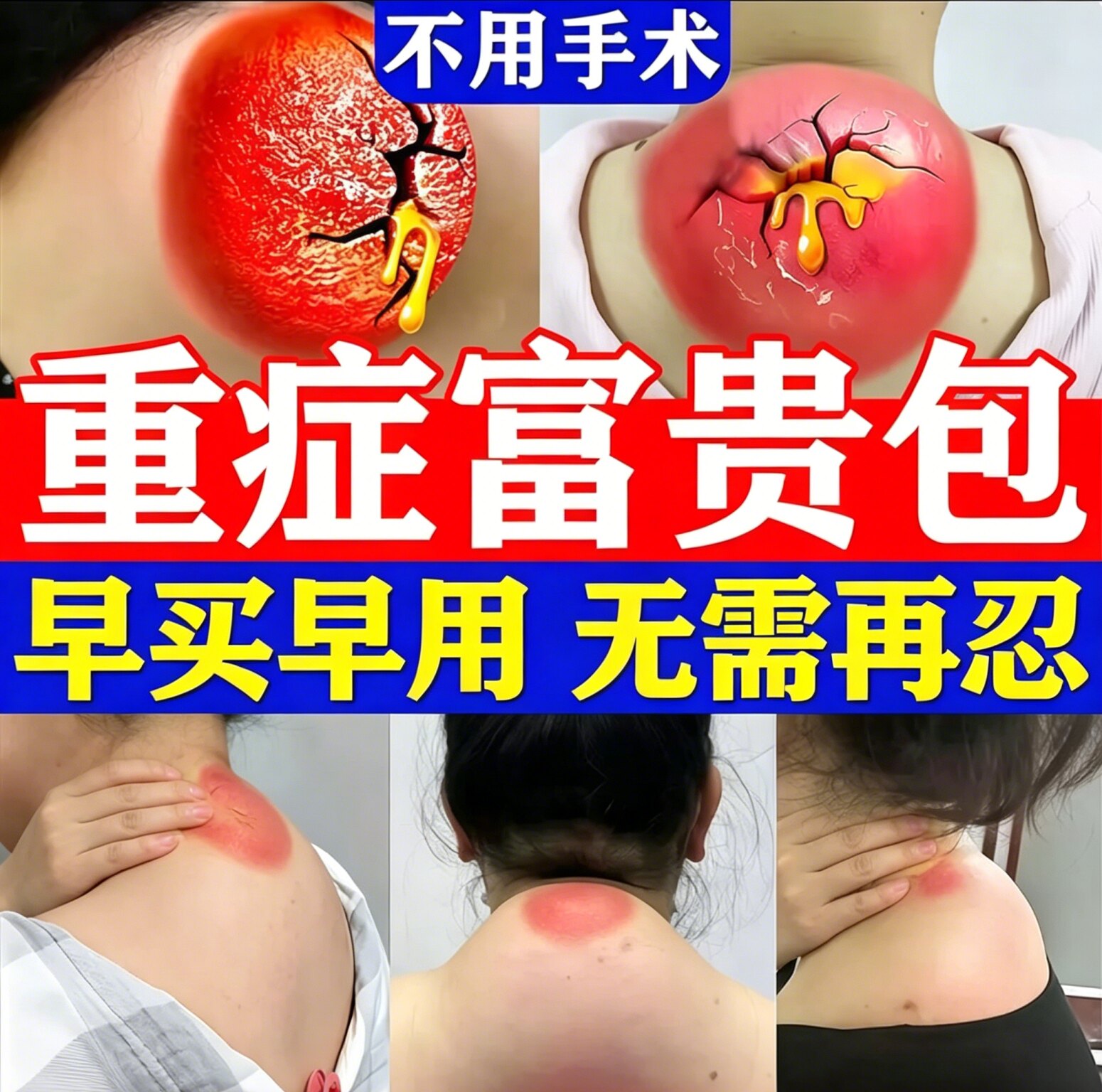 【当天消除】专研富贵包只买一次