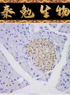赛维尔 货号：GF001-50T RNASweAMI™ 原位杂交DAB检测试剂盒