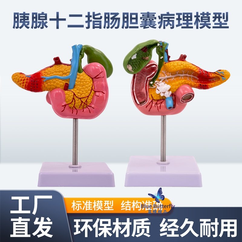 蓝蝶模型病理胆囊脾胰十二指肠