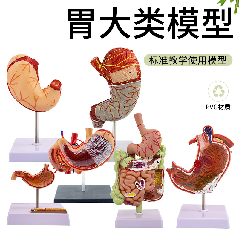 蓝蝶消化科胃病理器官教学模型