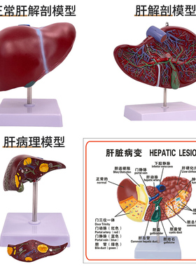 15009肝、胆囊放大模型 人体肝胆囊肝脏人体消化器官内脏解剖模型