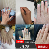 假肢假手指仿真脚趾残疾人义肢半指德国进口硅胶美容手套量身定做