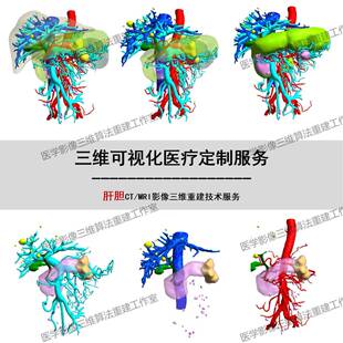 Mimics肝胆CT MRI医学三维重建DICOM影像STL NII三维可视化3D打印