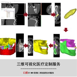Mimics口腔CBCT三维重建全制作流程一对一教学