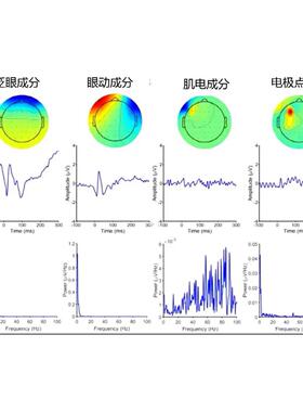 脑电数据分析Matlab心电eeglab可视化tobii眼动数据分析