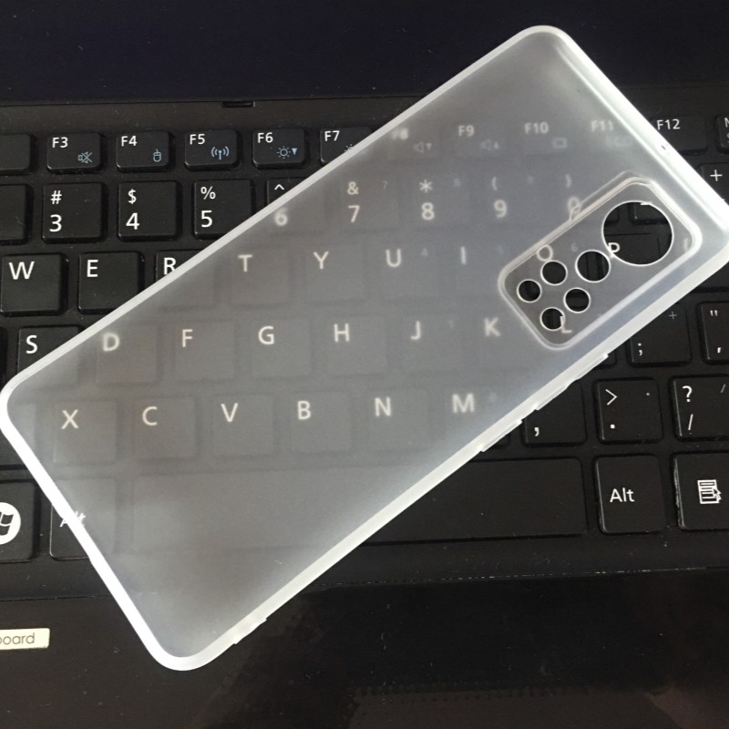 适用 中兴ZTE天机 Axon 30 屏下版 30S 硅胶 手机壳 透明保护套 手机套 保护壳 软壳 钢化膜