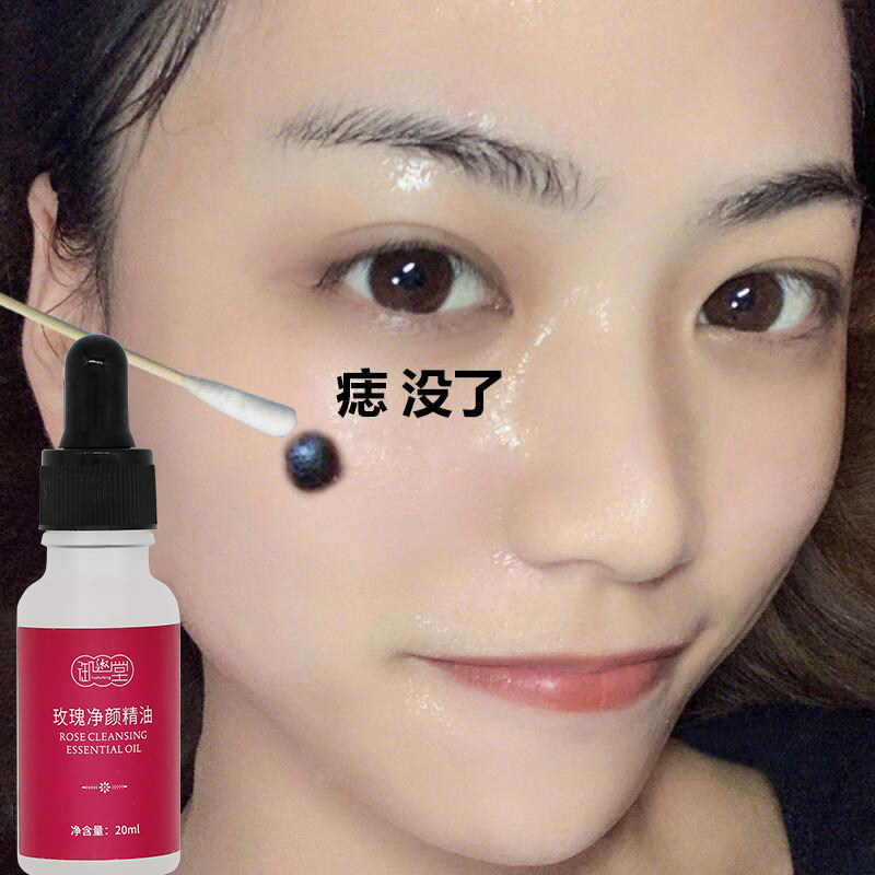 去除脸上一切黑点斑点 158三瓶一疗程 净颜洁面精油 白净好脸色