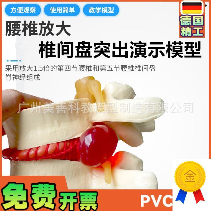 椎间盘模型正品医学人体腰椎突出脊柱脊椎骨病Q理演示关节标准模
