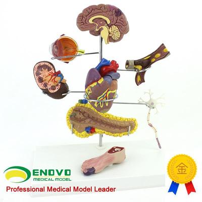 ENOVO颐诺人体医学糖尿病x模型并发症大脑心脏胰腺神经元足内外科