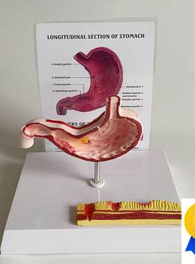 胃模型病理粘膜食道医患人体胃结构消F化器官临床医患沟通医药礼