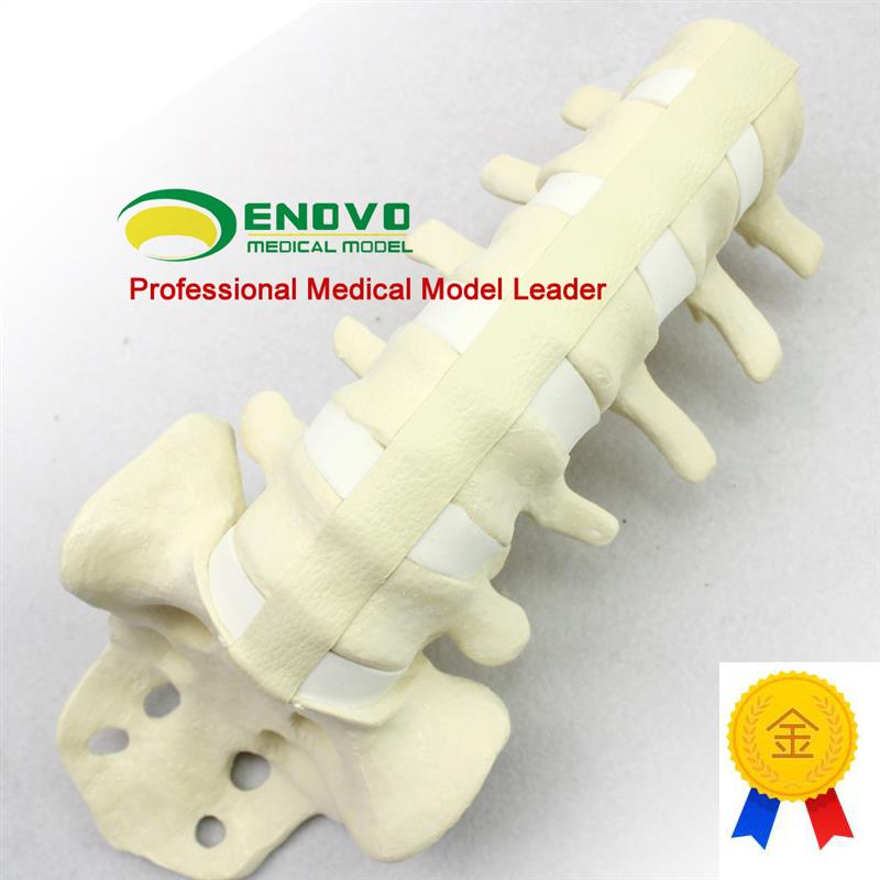 ENOVaO颐诺人体仿真腰椎尾骨模型骨科手术前Sawbone人体腰椎钉棒