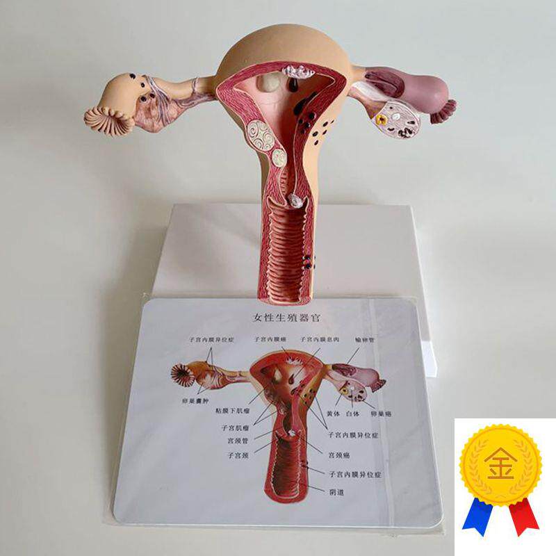 康泰医学子宫模型病理输卵管卵巢妇科生殖医药P促销礼直播跨境热
