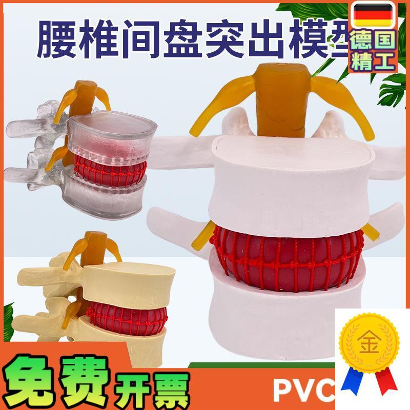 腰椎模型教学医学人体腰椎间盘受压演示脊柱骨突V出病理骨质教具