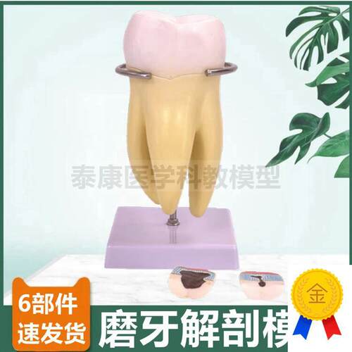 牙齿模型切牙尖牙磨牙拆卸口腔牙医牙科I教学标本龋齿蛀牙发展过
