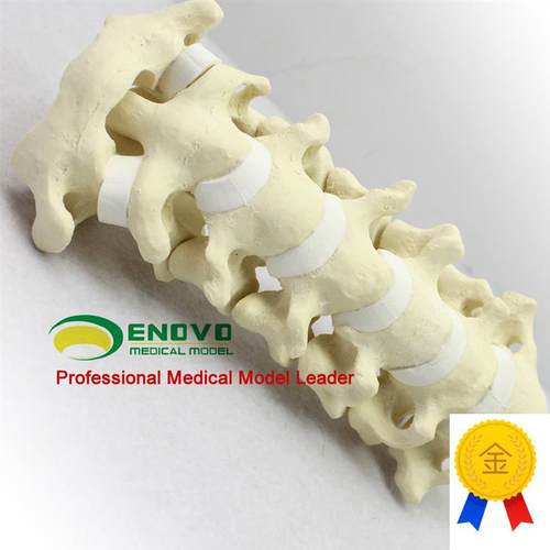 ENOVO颐诺骨科仿真人体颈椎模型医学骨科手术仿真骨Y颈椎前路后
