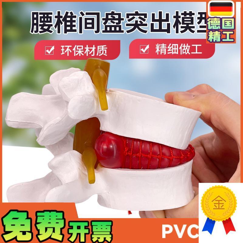 腰椎放大腰椎间盘受压演示模型人体脊柱K脊椎骨病理演示关节医学