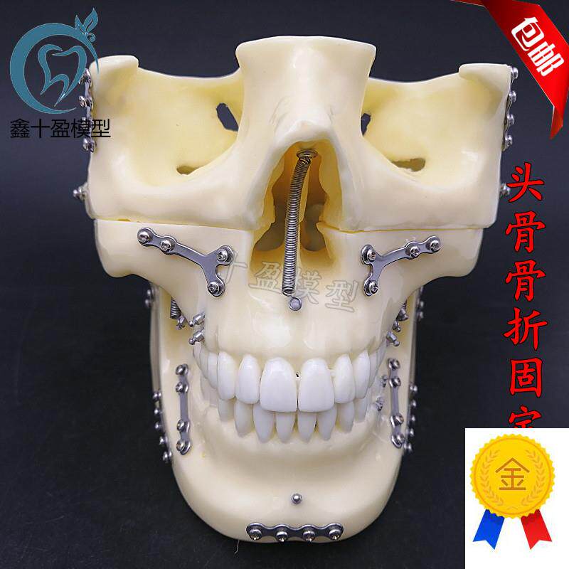 牙科种植支抗钉模型头颅骨折固定模型头颅骨口腔X模型医学教学