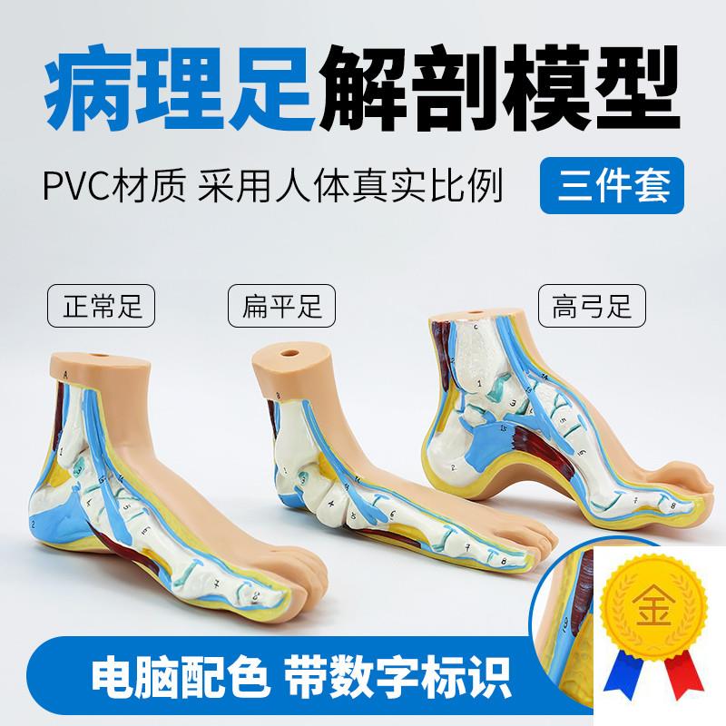 老款足部模型人体脚掌肌肉弓形脚掌模J型脚解剖模型平板足正常足