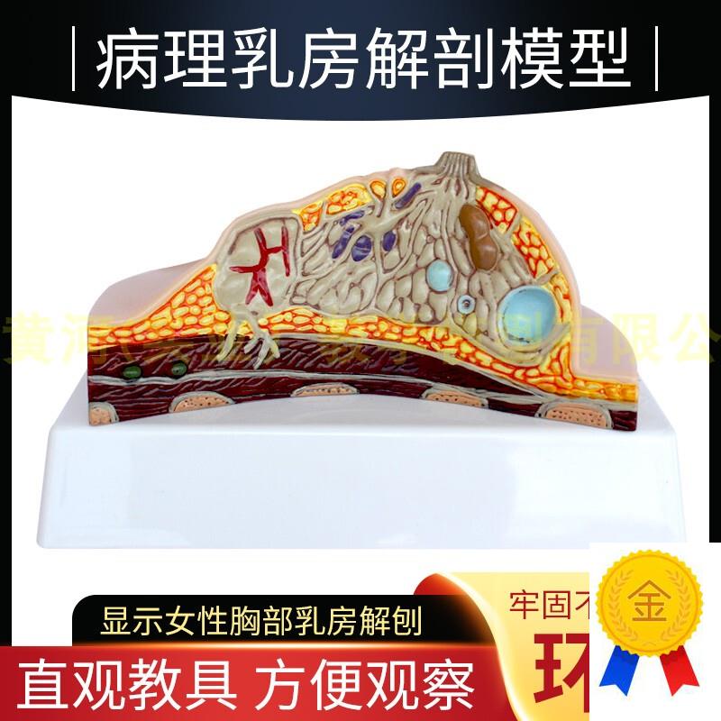 乳房模型胸部解剖模型静止期哺乳期女性病变M乳腺结构乳房医学教