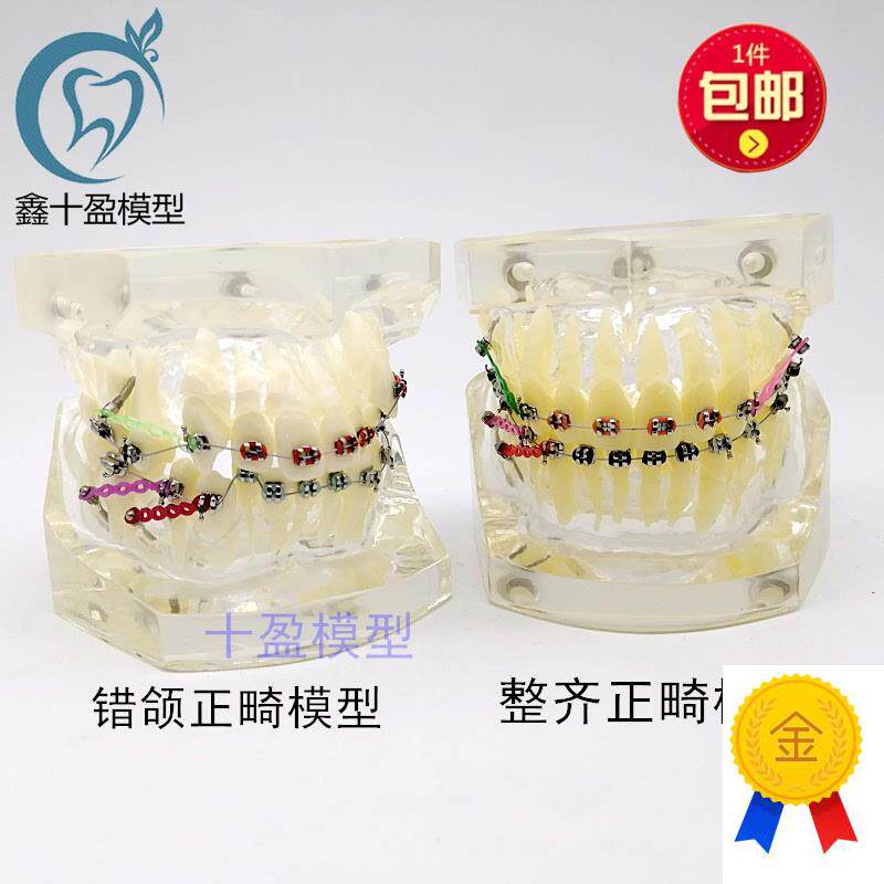 牙科正畸模型透明错颌矫正展示模C型结扎丝托槽正畸带支抗钉牙列