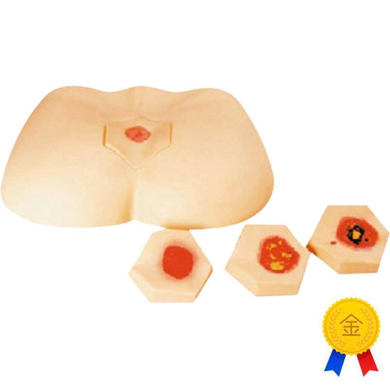 阶段褥疮护理模型H9S0F护理模型