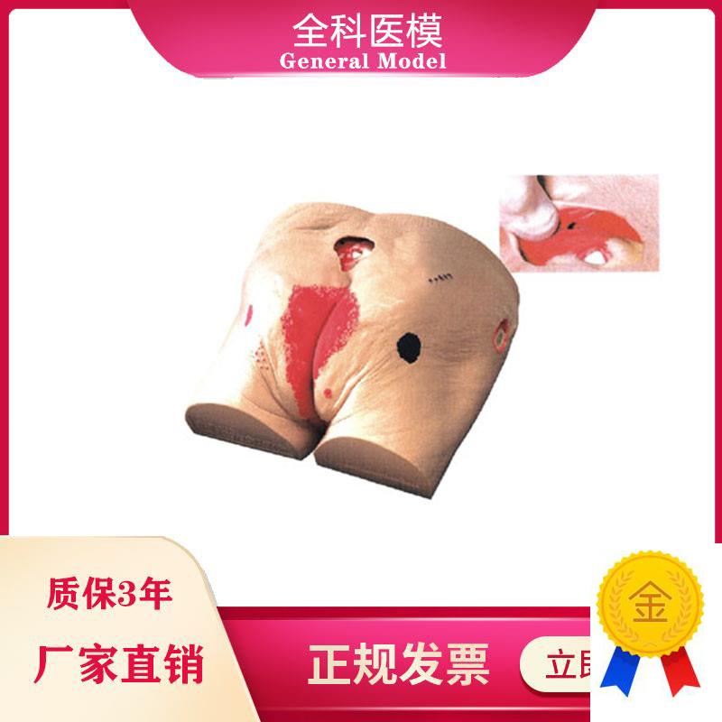褥疮模型压疮伤口模型高级老年人压疮褥疮仿O真护理模型医教学用