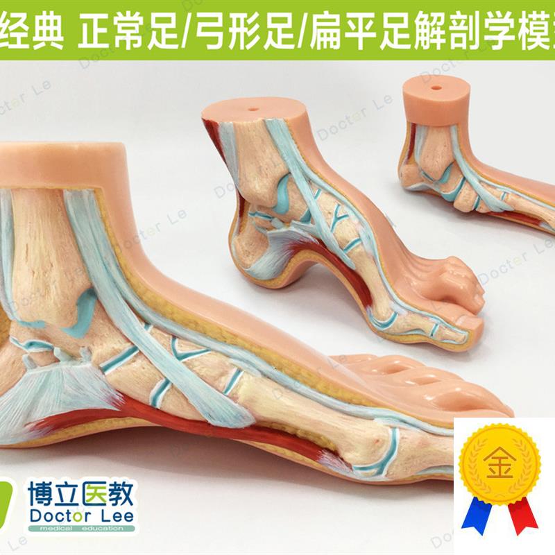 高端3款b1:1足病理对比扁平足弓形足健康足模型走路姿势矫正模型