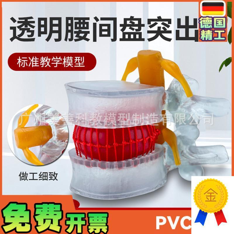 腰椎放大腰椎间盘模q型挤压突出演示脊柱脊椎骨病理演示模型