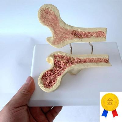 人体股骨骨质疏松模型股骨剖面解剖模型人O体骨骼模型腿骨模型