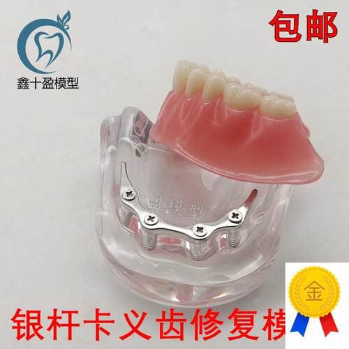 牙科口腔模d型齿科修复模型银杆卡医患沟通种植修复6008包邮