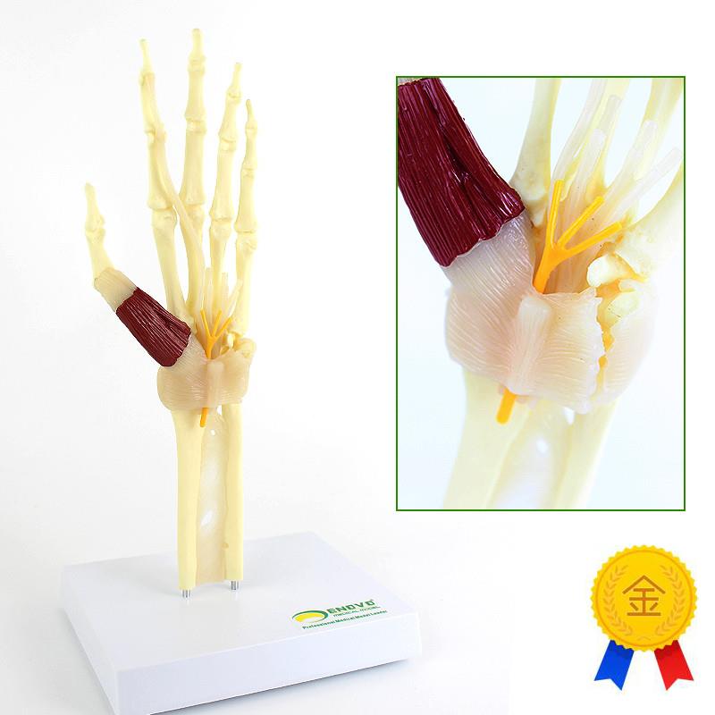 ENOVO颐诺人体腕关节综合征模型腕管综合征正中神Z经肘关节桡