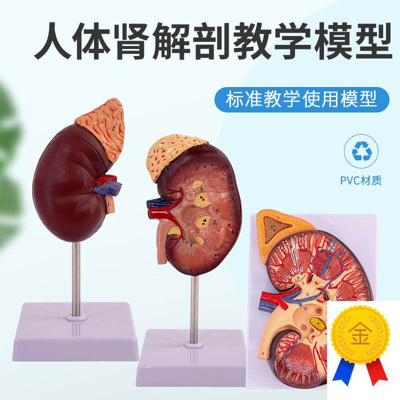 人体肾脏模型肾解剖附肾上腺放大D模型病变肾脏人体内脏器官解剖