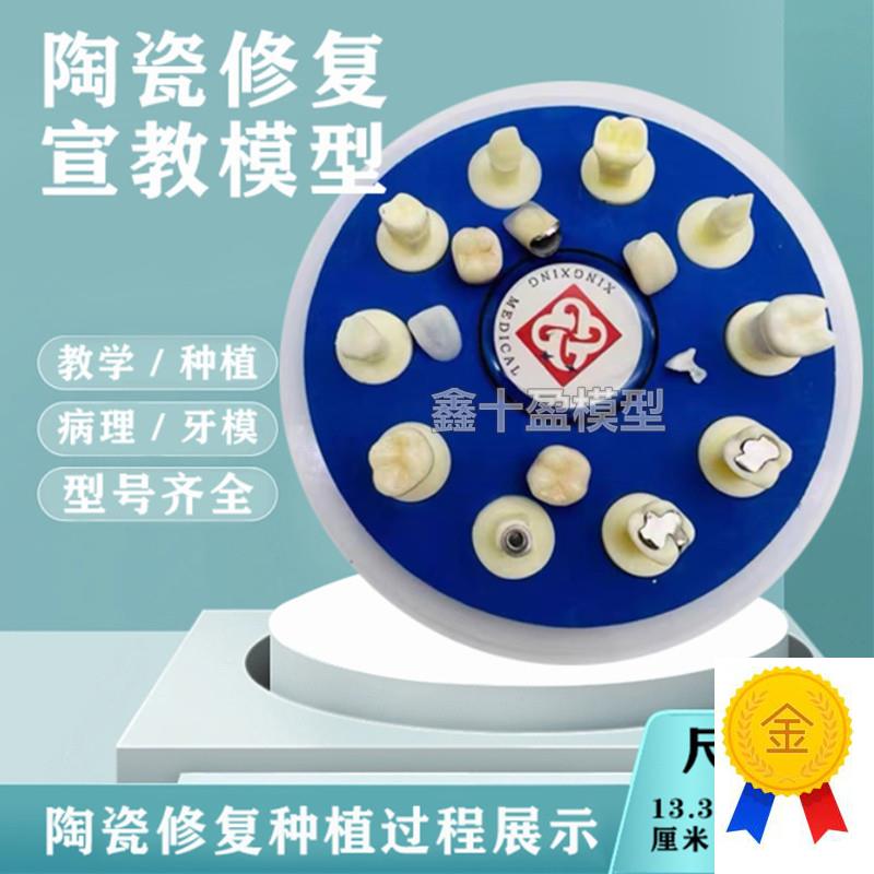 牙齿模型口腔教h学陶瓷10*1仿真修复治疗过程种植根管病理医患沟