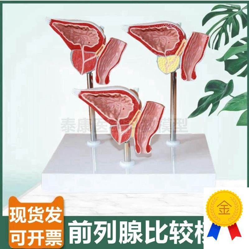 前列腺模型男科生殖泌尿r器官膀胱肾脏解剖内外生殖器睾丸内分泌