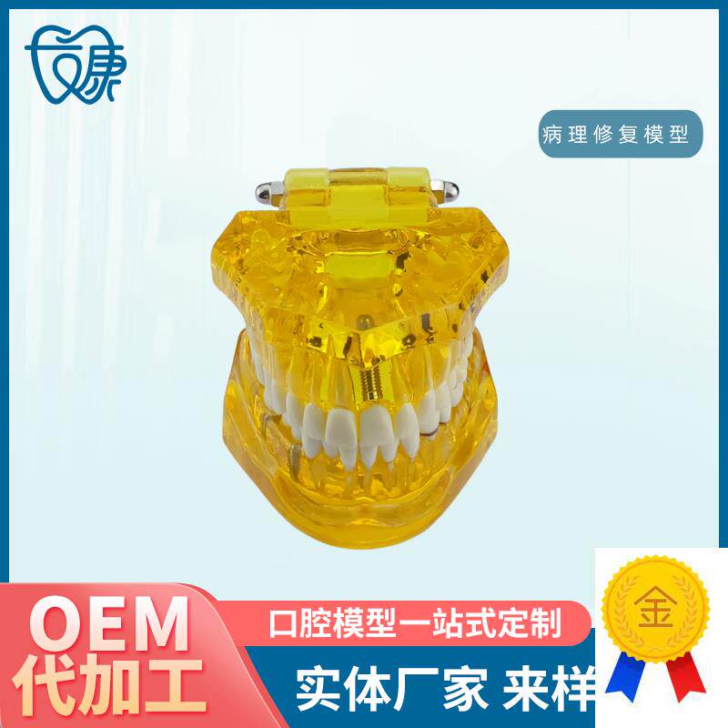 牙齿模型病理修k复可拆卸正畸口腔病理牙模型牙科医患活动沟通