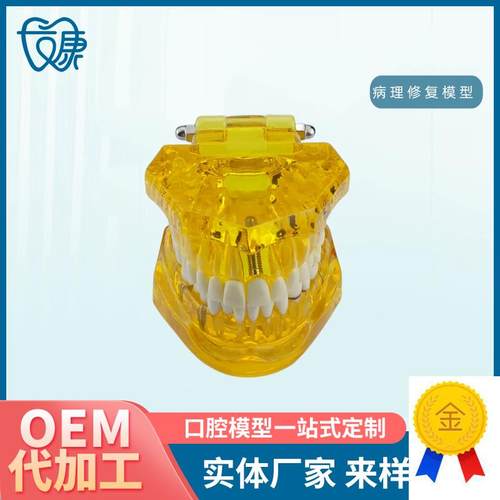 牙齿模型病理修k复可拆卸正畸口腔病理牙模型牙科医患活动沟通