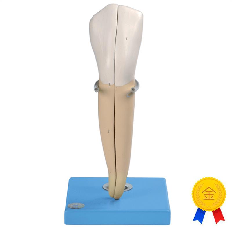 尖牙模型B1D0004/2