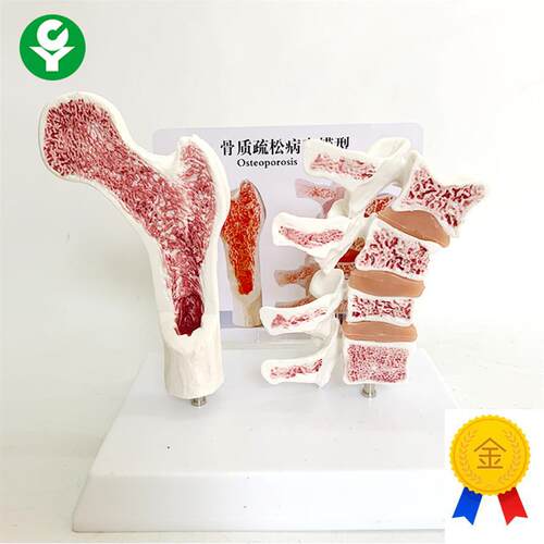 人体股骨骨质疏松解剖模型腿骨解剖面脊柱切面R标本病变腰椎模型