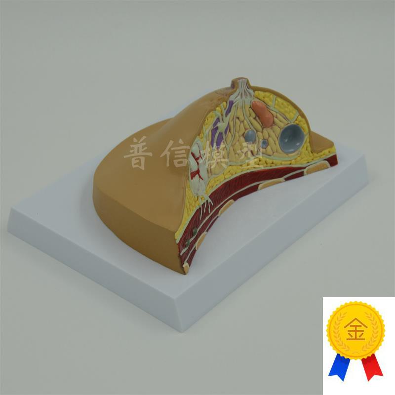 普信乳腺a病变病理乳房模型妇科医用乳房解剖模型医用教学模型