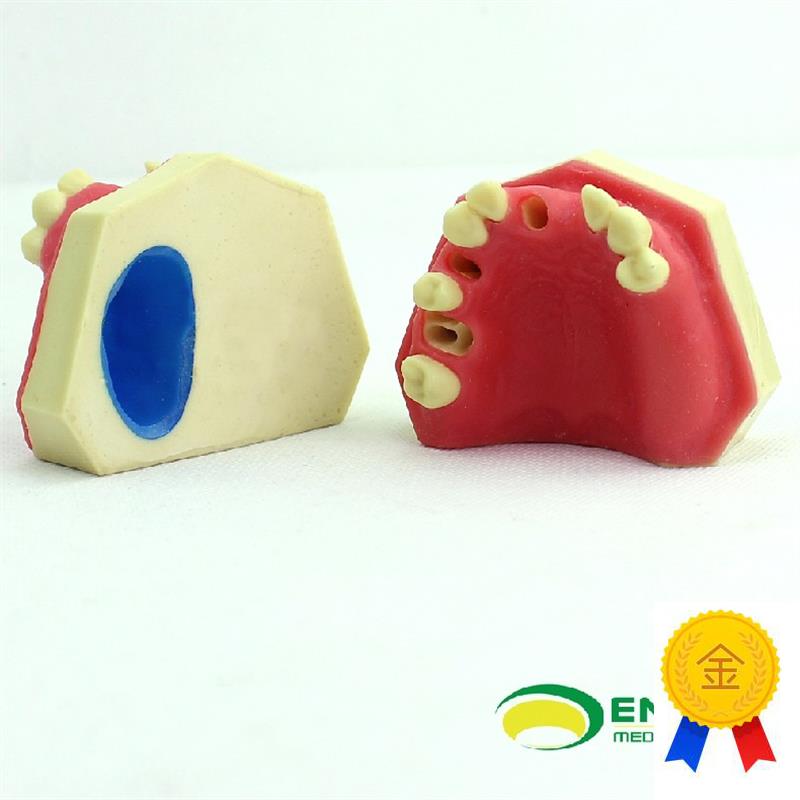 ENOVOc颐诺口腔即刻种植练习操作模型上颌骨上颌窦牙列缺失种植体